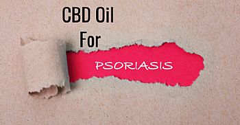 CBD & Ψωρίαση